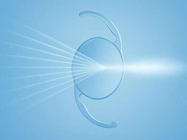 EDOF (Extended Depth of Focus) Lenses Explained photo