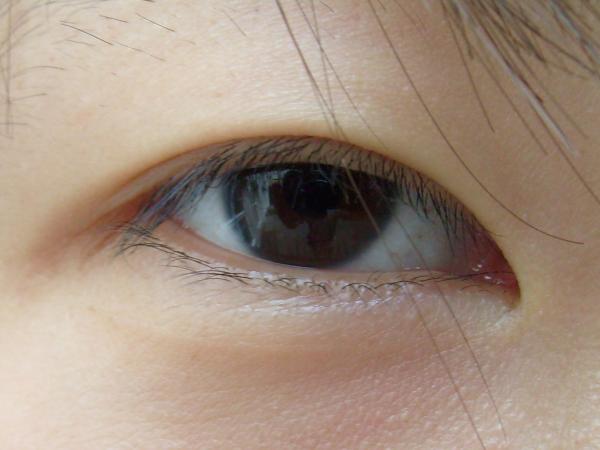 Exploring Epicanthus and Its Influence on Facial Features photo