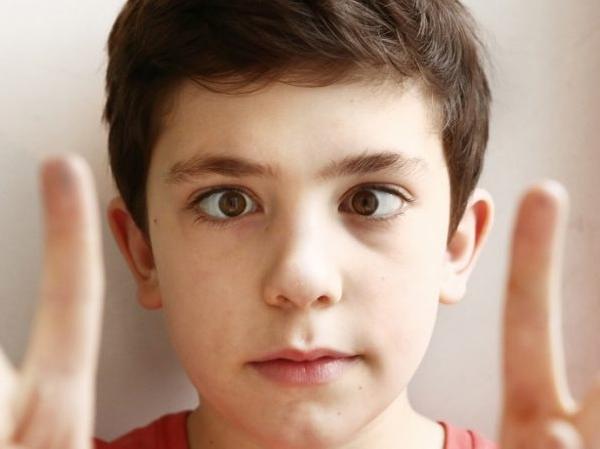 Amblyopia: What Is Lazy Eye? photo