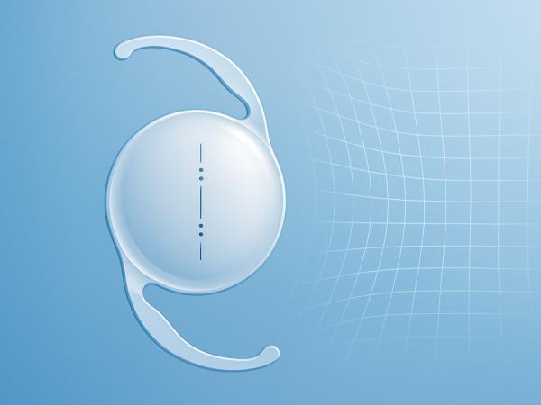 Toric IOLs for Astigmatism photo