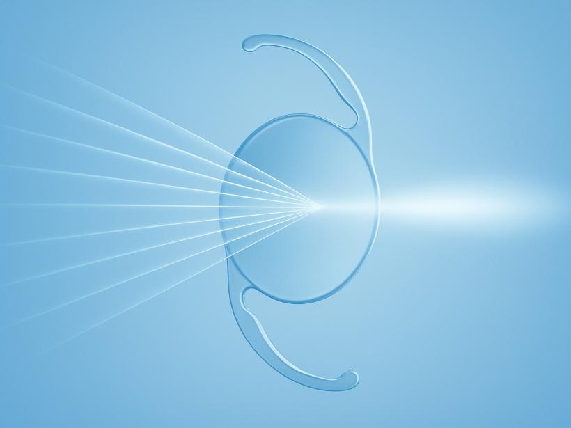 EDOF (Extended Depth of Focus) Lenses Explained photo