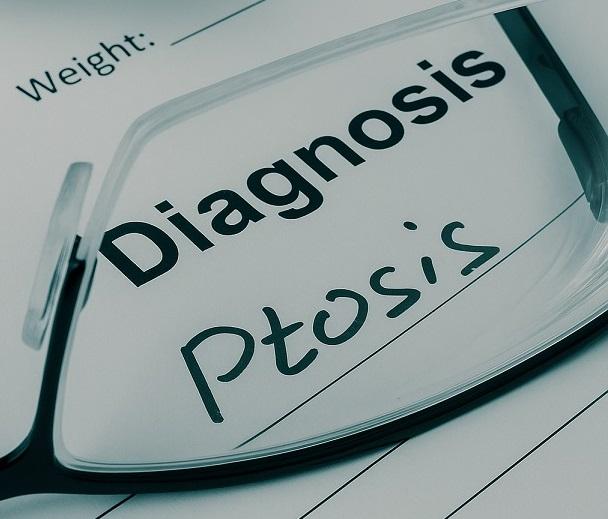 Ptosis (Droopy Eyelid): Causes, Symptoms, and Expert Treatment Options photo