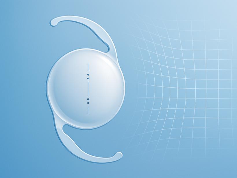 Toric IOLs for Astigmatism photo