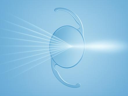 EDOF (Extended Depth of Focus) Lenses Explained photo