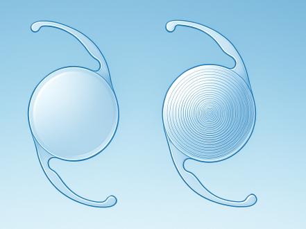 Monofocal vs. Multifocal IOLs: Which Is Right for You? photo
