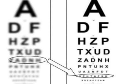 The improvement of vision in difficult cases is possible thanks to neuroadaptation photo