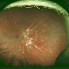 Retina Group of Florida: Eduardo Uchiyama, MD. Vitreo-Retinal Surgeon & Uveitis Specialist photo