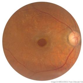 Northwest Wa Eye Specialists photo