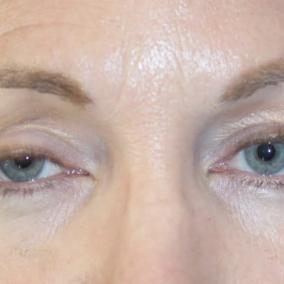Samuel Baharestani, M.D. - SightMD Manhasset photo