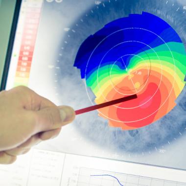 Keratoconus Specialists of Maryland photo