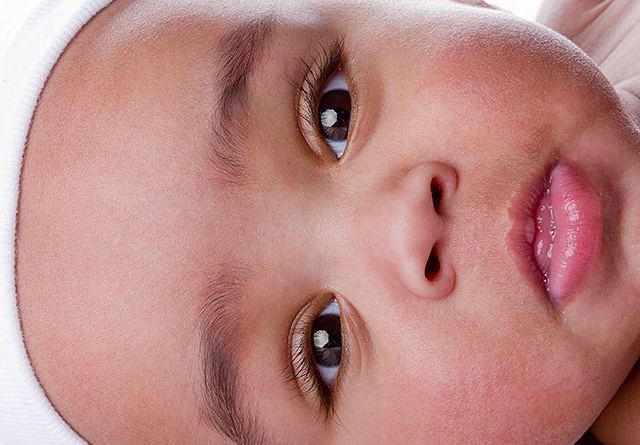 Children's Eye Care: Alexandra O Apkarian, MD photo