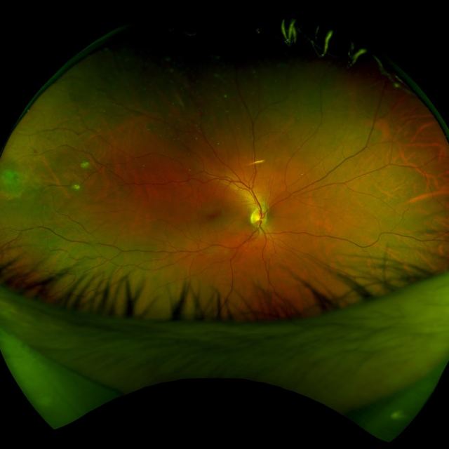 Conshohocken Eye Associates photo