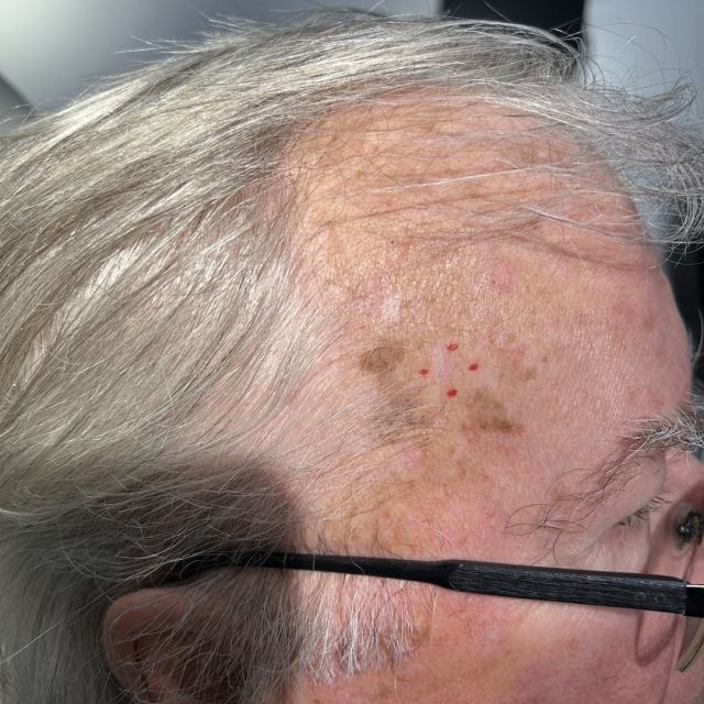 Dr. Aron D. Rose, MD photo