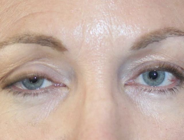 Samuel Baharestani, M.D. - SightMD Manhasset photo