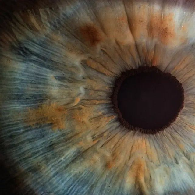 Tacoma Family Eyecare photo