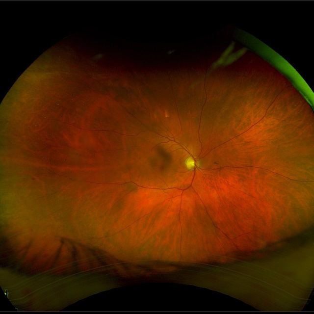 Vitreo-Retinal Consultants, Inc. photo
