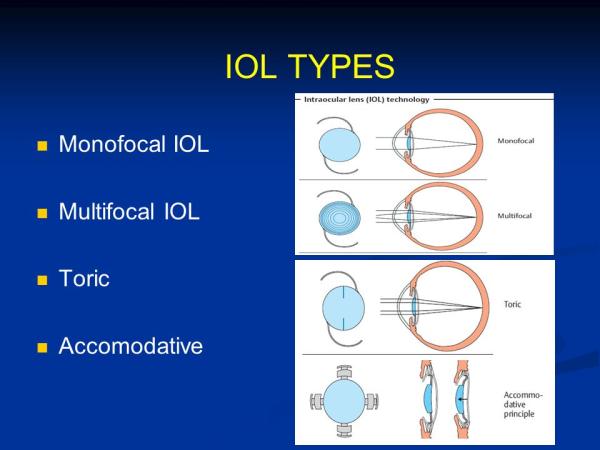 intraocular lens types