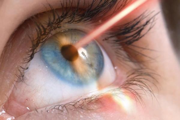 Life-changing medical procedure: reasons for laser vision correction photo