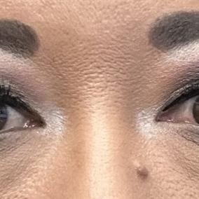 Cataract & Cornea Surgical photo