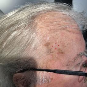Dr. Aron D. Rose, MD photo