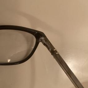 Dry Eyes-Allergy Care photo