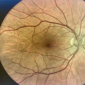 Eye Gallery photo
