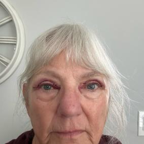 Wills Eye Hospital: Penne Robert B MD photo