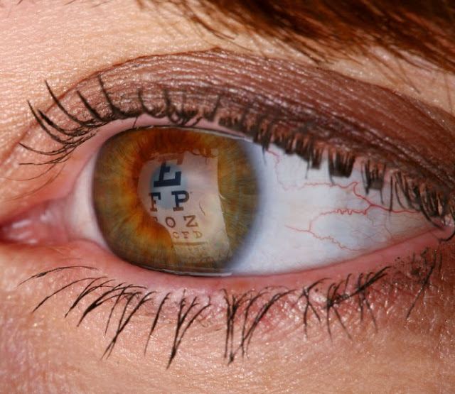 Connecticut Eye Care Center: Patrick Albergo MD, Duane Austin MD photo