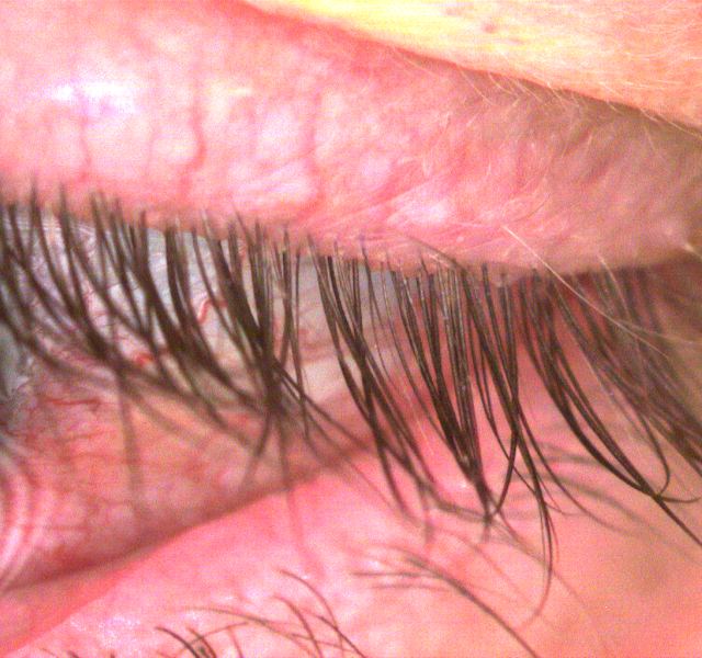 The Dry Eye Center of Maryland photo