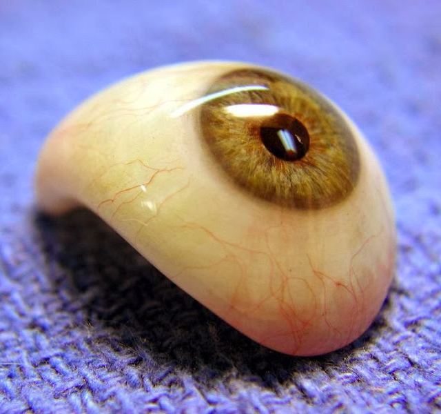 Ocular Prosthetics Inc - California Ocularist photo