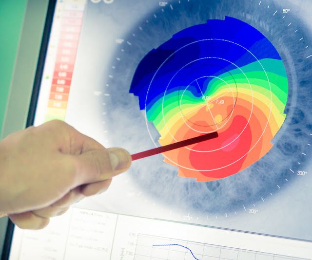Keratoconus Specialists of Maryland photo