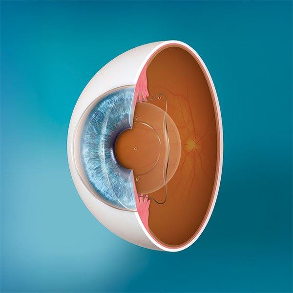 Beach Eye Care photo