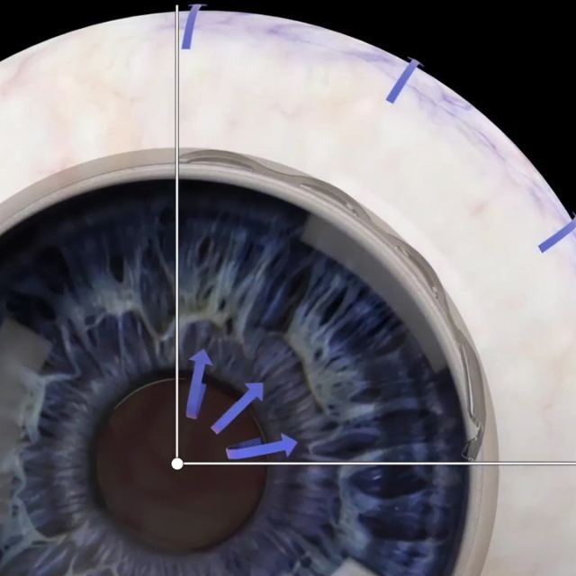 Edison Eye Group: Press Jerrold MD photo