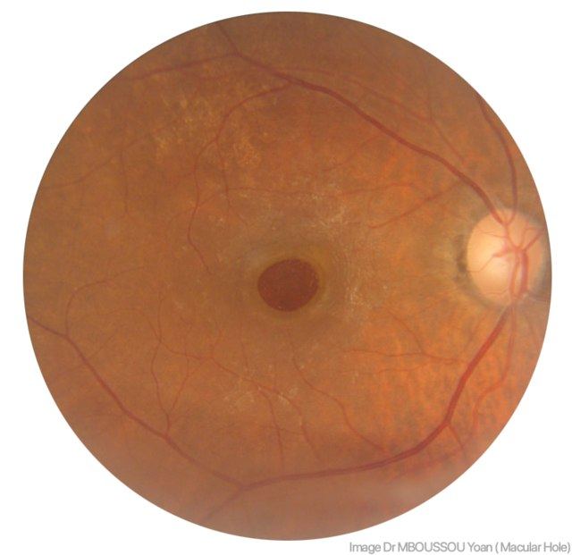 Northwest Wa Eye Specialists photo