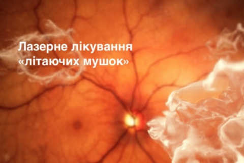 Laser treatment of eye floaters