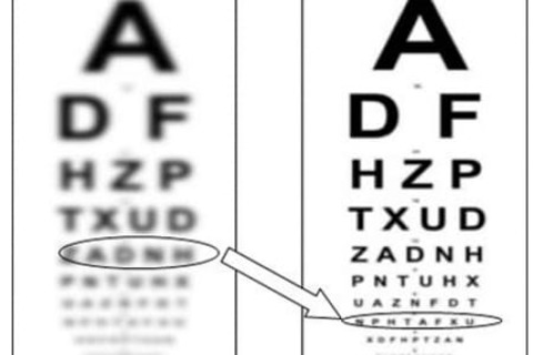 The improvement of vision in difficult cases is possible thanks to neuroadaptation